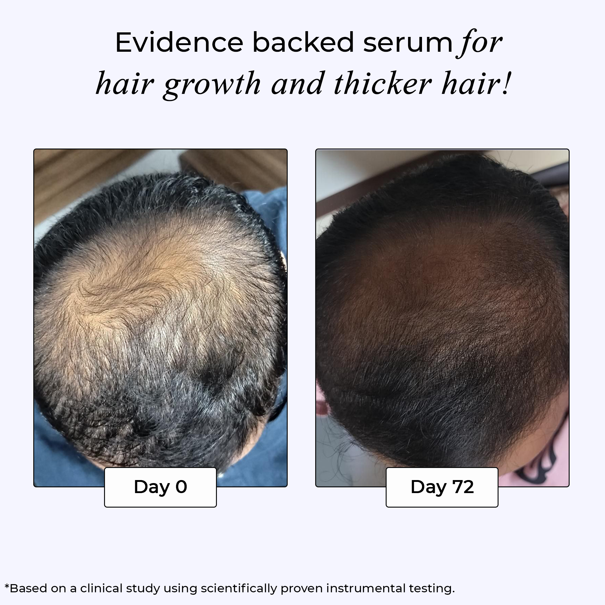 Dr. Su Revive Hair Growth Serum